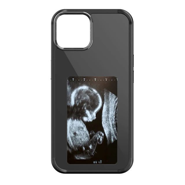Snapframe™ E-ink Phone Case Snapframe™ E-ink Phone Case