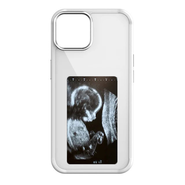 Snapframe™ E-ink Phone Case